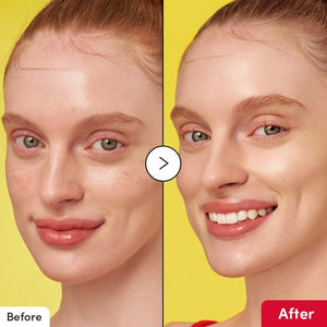 EqualBerry - Vitamin Illuminating Serum(30ml)